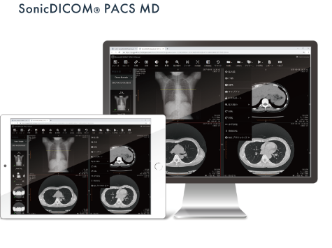 医用画像管理システム Sonic DICOM PACS