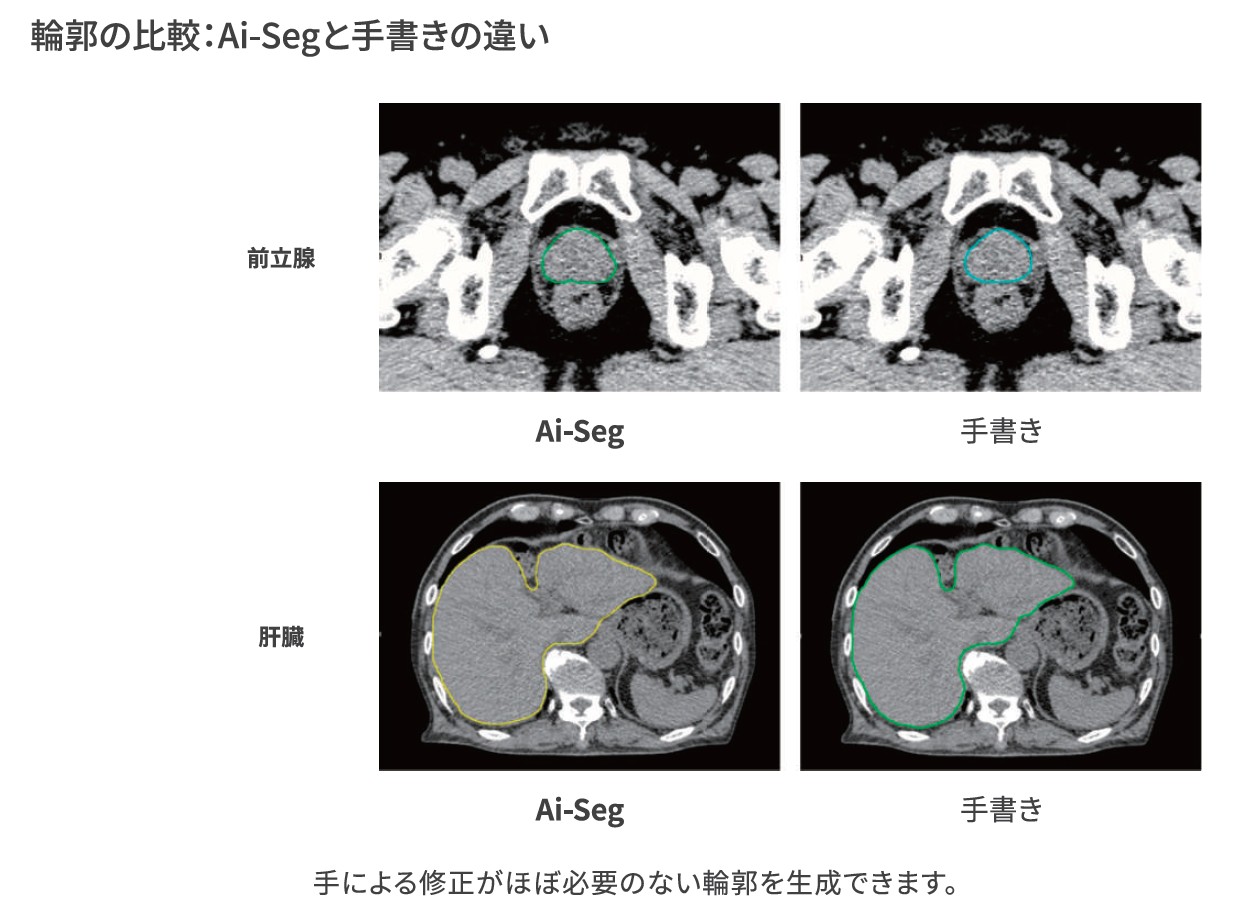 高精度で迅速な輪郭作成